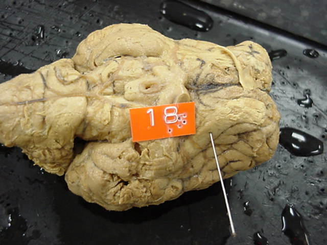 olfactory tract