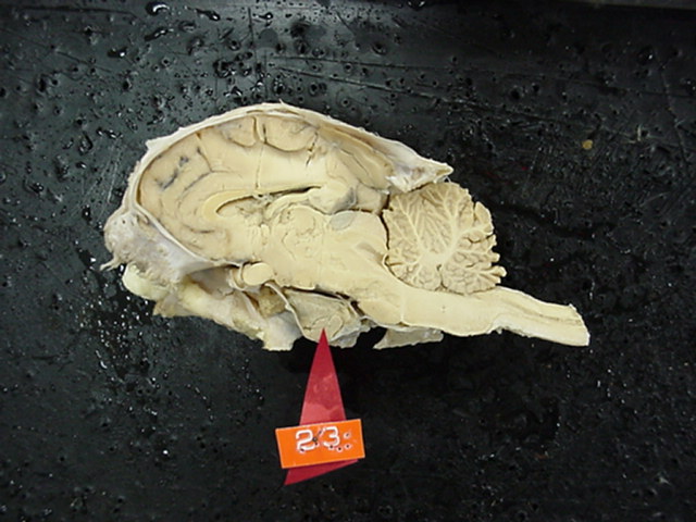 pituitary