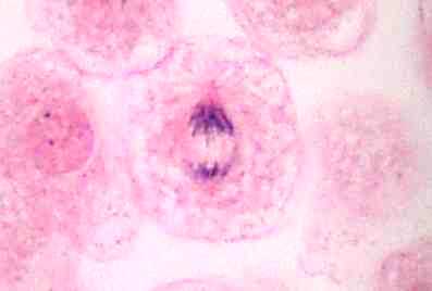 anaphase