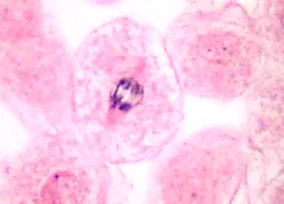 anaphase