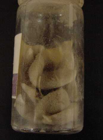 Porifera - calceria