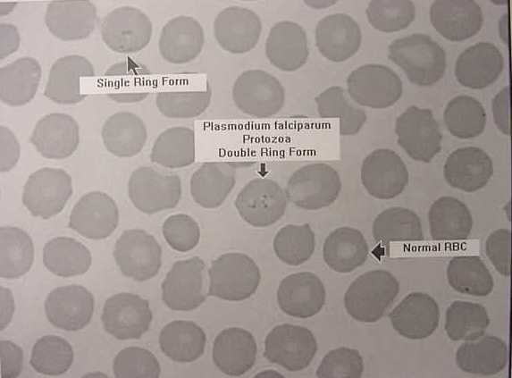 plasmodium