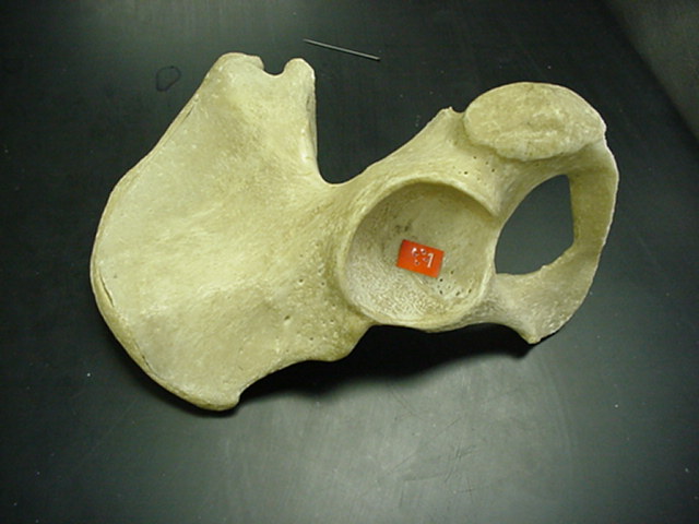 acetabulum