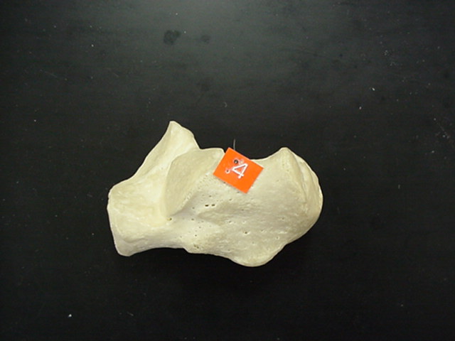 calcaneus