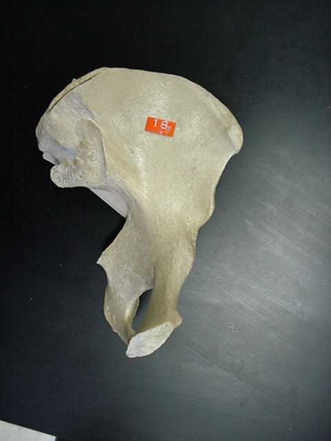 ilium of coxal bone