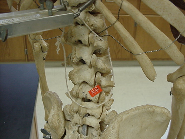 lumbar vertebrae