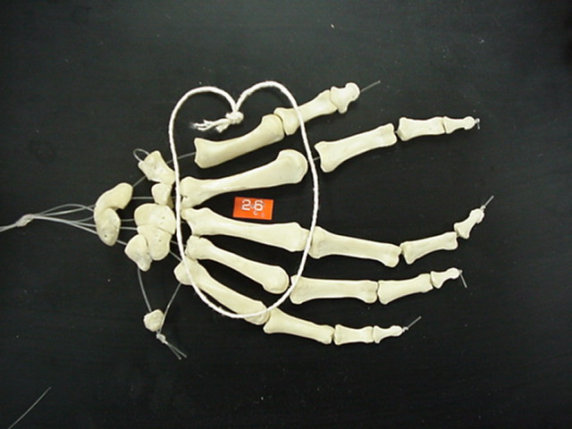 metacarpal bones