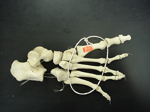 metatarsal bones
