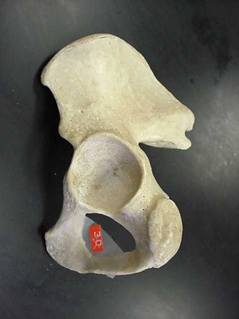 obturator foramen