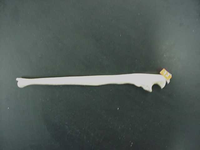 olecranon process of ulna