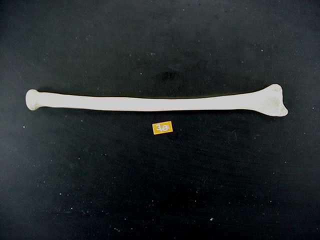 radius