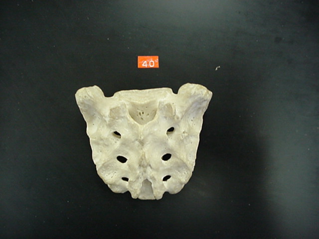 sacrum