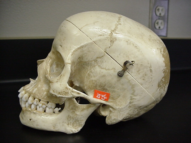 temporal bone