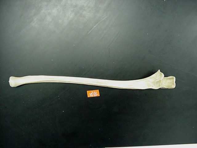 ulna