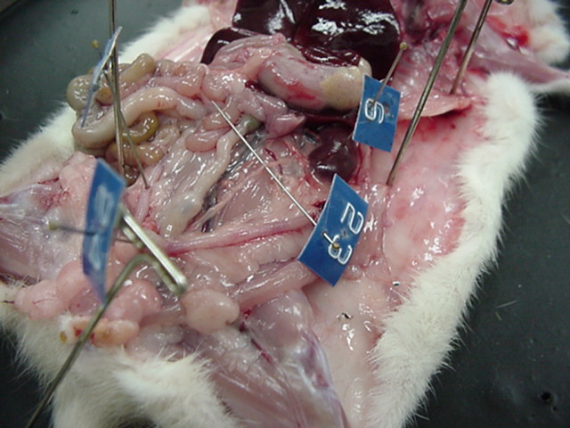 ureter