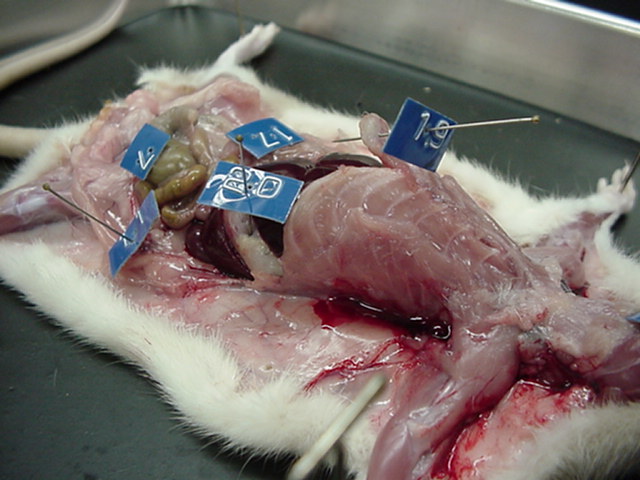 lateral - abdominal organs